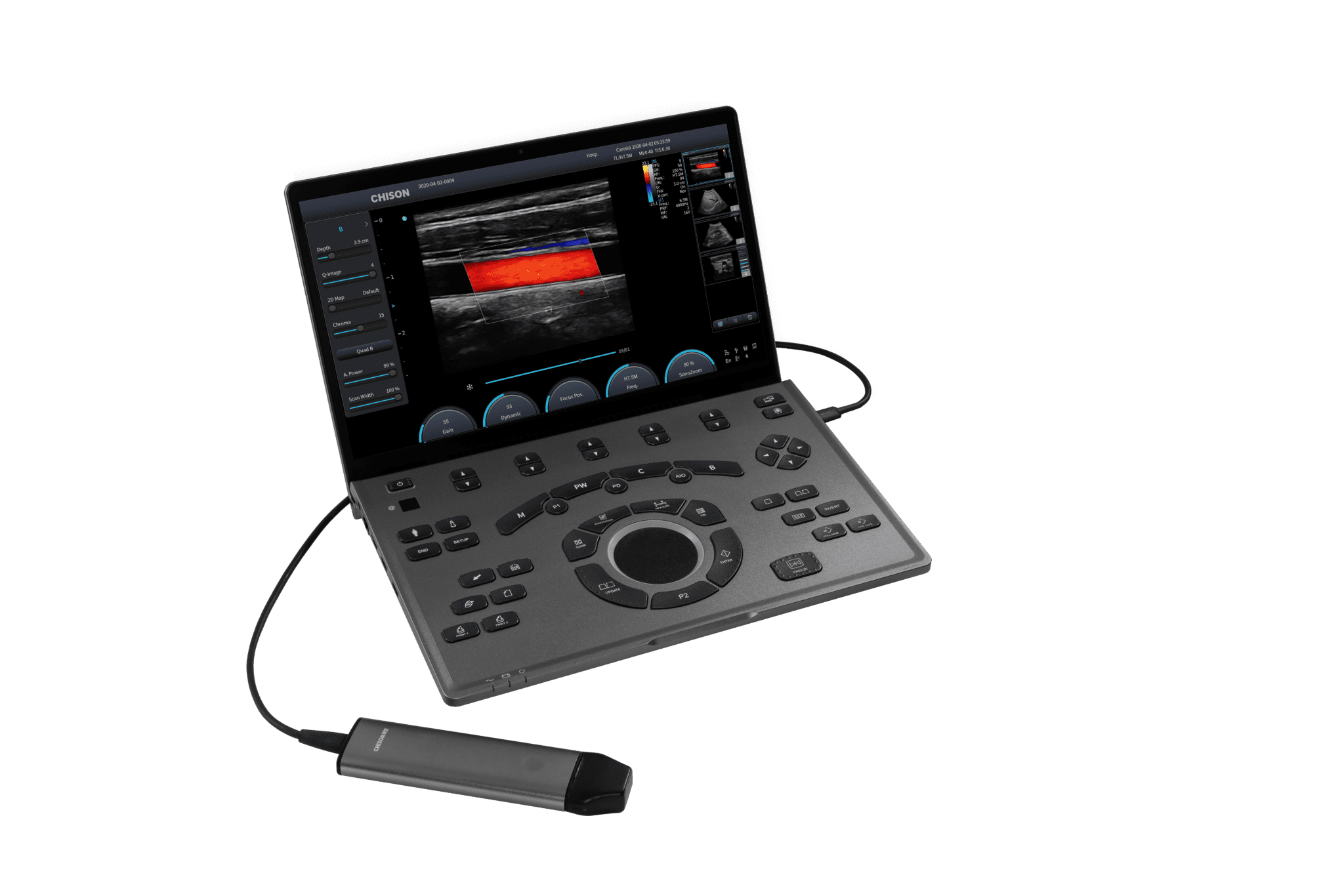 sonoair